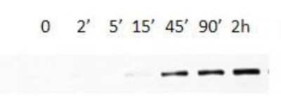 Western Blot: eIF4G1 [p Ser1231] Antibody [NBP1-04965]